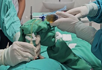 Prosedur Amnioreduksi oleh peserta PPDS-2 Fetomaternal